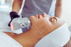 Managing Facial Skin Laxity with HIFU-Based Medical Care