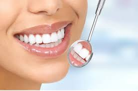 Hollywood Smile Secrets: High-Tech Dental Veneers for Stunning Oral Care